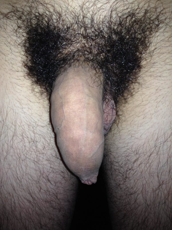 Big Hairy Uncut Softie