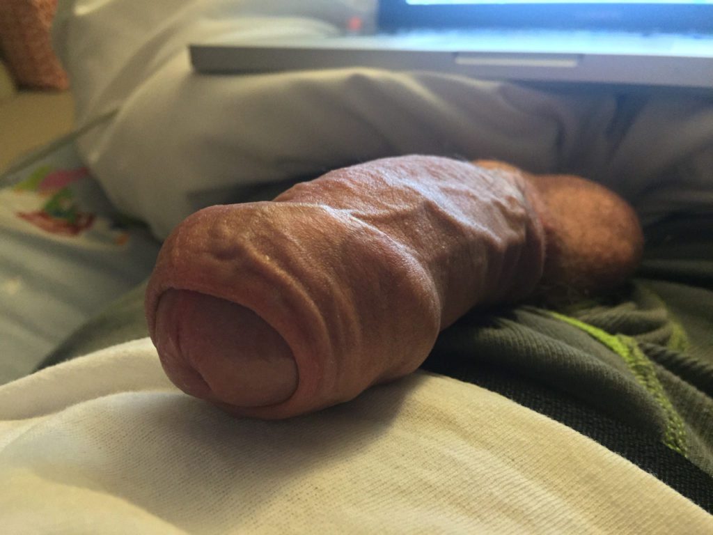 Penis head covered