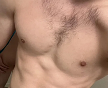 Hairy Chest
